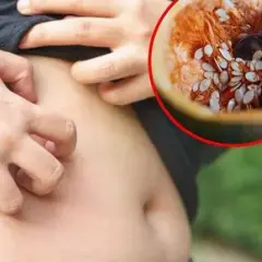 Czy odrobaczanie jest bezpieczne? Poznaj fakty i rozwiej wątpliwości